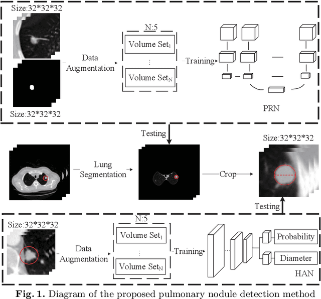 Figure 1 for A Pulmonary Nodule Detection Model Based on Progressive Resolution and Hierarchical Saliency