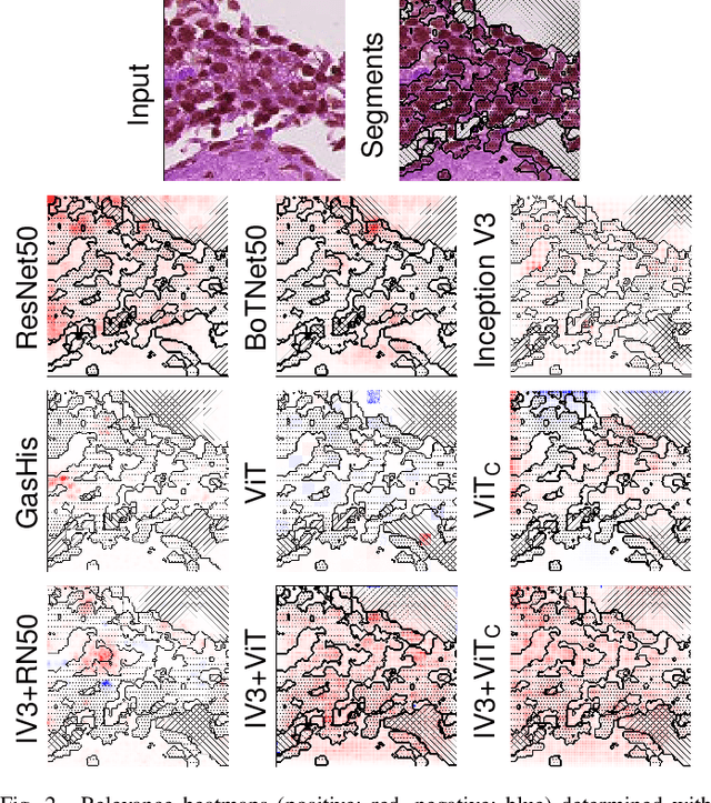 Figure 2 for From CNNs to Vision Transformers -- A Comprehensive Evaluation of Deep Learning Models for Histopathology
