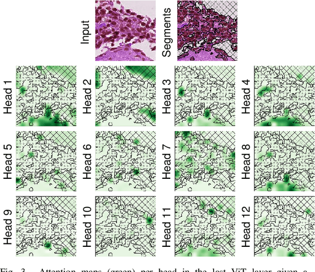 Figure 3 for From CNNs to Vision Transformers -- A Comprehensive Evaluation of Deep Learning Models for Histopathology
