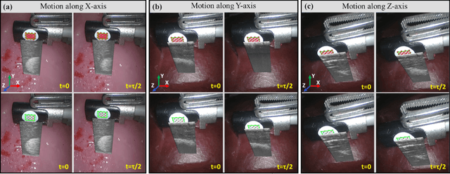 Figure 3 for Motion-Compensated Autonomous Scanning for Tumour Localisation using Intraoperative Ultrasound