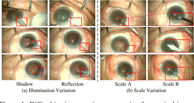 Figure 1 for BARNet: Bilinear Attention Network with Adaptive Receptive Field for Surgical Instrument Segmentation