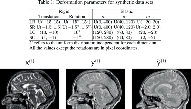Figure 2 for Deformation equivariant cross-modality image synthesis with paired non-aligned training data