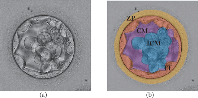 Figure 1 for Inner Cell Mass and Trophectoderm Segmentation in Human Blastocyst Images using Deep Neural Network