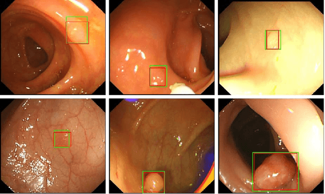 Figure 1 for Colorectal Polyp Detection in Real-world Scenario: Design and Experiment Study