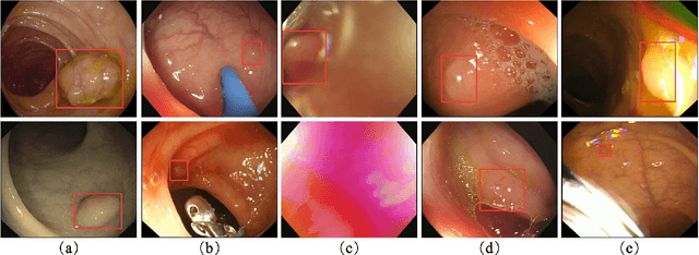 Figure 2 for Colorectal Polyp Detection in Real-world Scenario: Design and Experiment Study