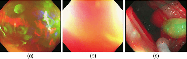 Figure 4 for Colorectal Polyp Detection in Real-world Scenario: Design and Experiment Study