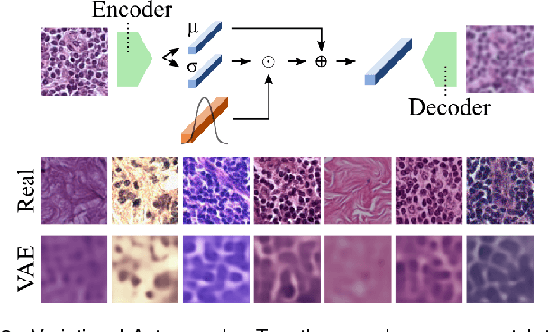 Figure 3 for Neural Image Compression for Gigapixel Histopathology Image Analysis