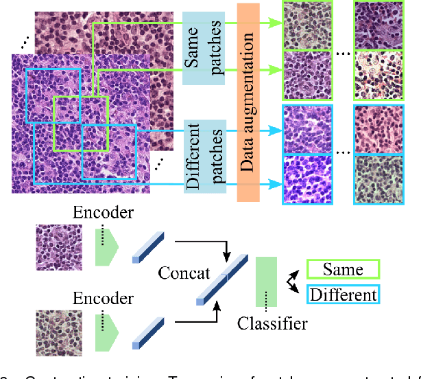Figure 4 for Neural Image Compression for Gigapixel Histopathology Image Analysis