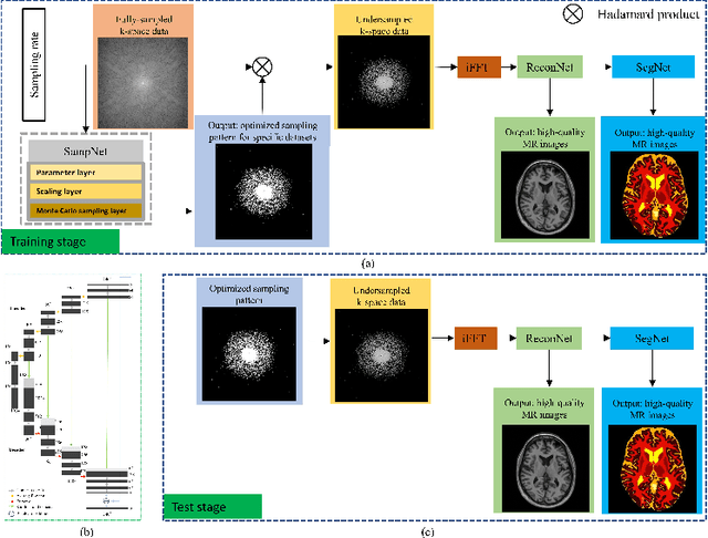 Figure 1 for One Network to Solve Them All: A Sequential Multi-Task Joint Learning Network Framework for MR Imaging Pipeline
