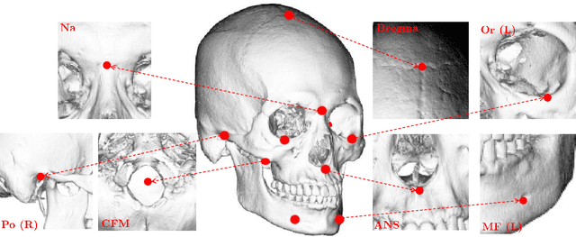 Figure 3 for Automated 3D cephalometric landmark identification using computerized tomography