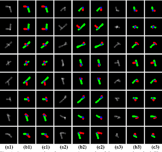 Figure 2 for Adversarial Multiscale Feature Learning for Overlapping Chromosome Segmentation