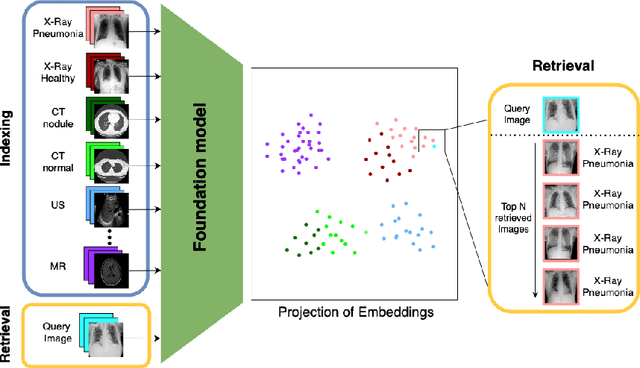 Figure 1 for Leveraging Foundation Models for Content-Based Medical Image Retrieval in Radiology