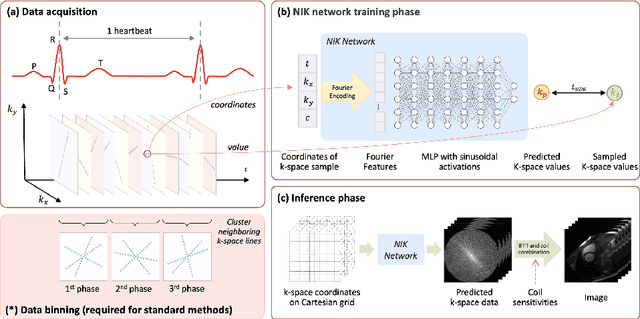 Figure 1 for Neural Implicit k-Space for Binning-free Non-Cartesian Cardiac MR Imaging