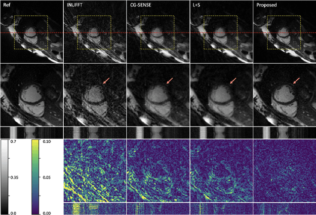 Figure 3 for Neural Implicit k-Space for Binning-free Non-Cartesian Cardiac MR Imaging