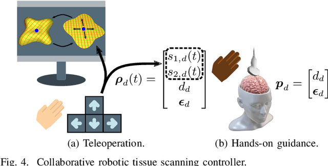Figure 4 for Towards Safe and Collaborative Robotic Ultrasound Tissue Scanning in Neurosurgery