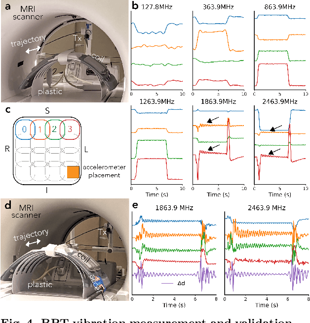 Figure 4 for Beat Pilot Tone: Versatile, Contact-Free Motion Sensing in MRI with Radio Frequency Intermodulation
