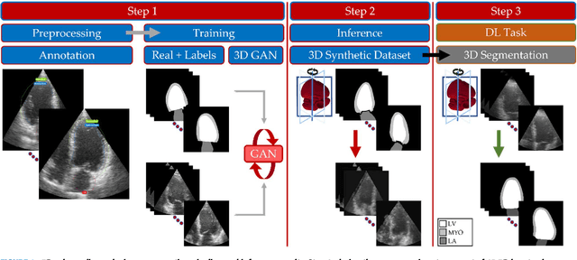 Figure 1 for A Data Augmentation Pipeline to Generate Synthetic Labeled Datasets of 3D Echocardiography Images using a GAN