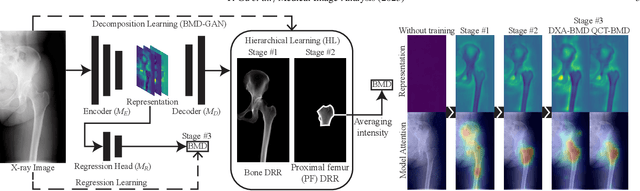 Figure 4 for Bone mineral density estimation from a plain X-ray image by learning decomposition into projections of bone-segmented computed tomography
