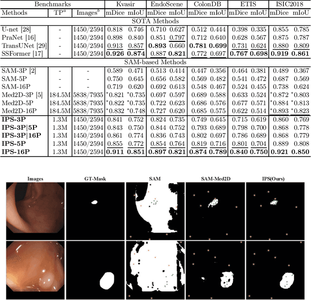 Figure 4 for ProMISe: Promptable Medical Image Segmentation using SAM