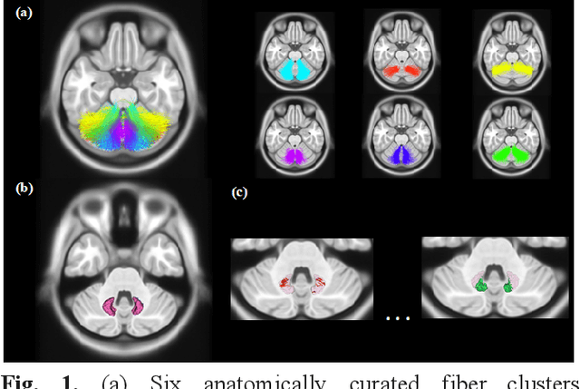 Figure 1 for Tractography-Based Parcellation of Cerebellar Dentate Nuclei via a Deep Nonnegative Matrix Factorization Clustering Method