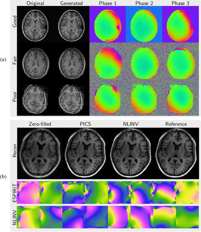 Figure 3 for Generative Image Priors for MRI Reconstruction Trained from Magnitude-Only Images