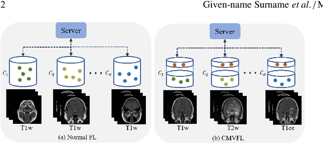 Figure 1 for Cross-Modal Vertical Federated Learning for MRI Reconstruction