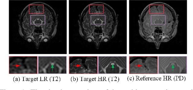 Figure 1 for Deep Unfolding Convolutional Dictionary Model for Multi-Contrast MRI Super-resolution and Reconstruction