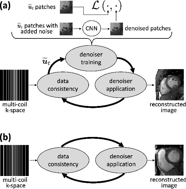 Figure 1 for MRI Recovery with Self-Calibrated Denoisers without Fully-Sampled Data