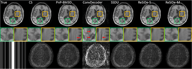 Figure 3 for MRI Recovery with Self-Calibrated Denoisers without Fully-Sampled Data