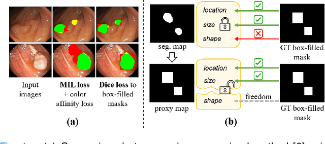 Figure 1 for IBoxCLA: Towards Robust Box-supervised Segmentation of Polyp via Improved Box-dice and Contrastive Latent-anchors