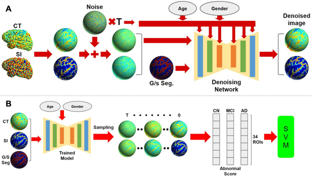 Figure 1 for Anatomy-Guided Surface Diffusion Model for Alzheimer's Disease Normative Modeling