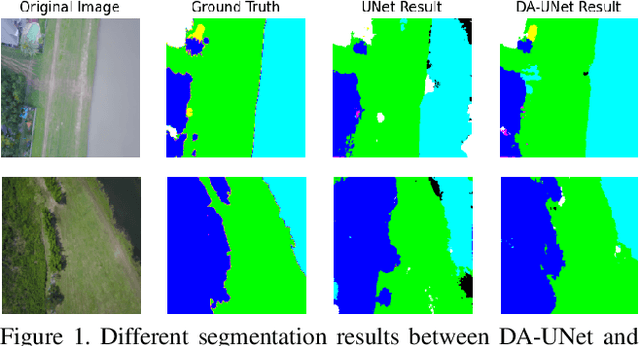 Figure 1 for Deep Attention Unet: A Network Model with Global Feature Perception Ability
