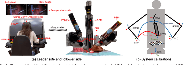 Figure 2 for Towards Safer Robot-Assisted Surgery: A Markerless Augmented Reality Framework