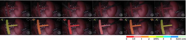 Figure 3 for Towards Safer Robot-Assisted Surgery: A Markerless Augmented Reality Framework