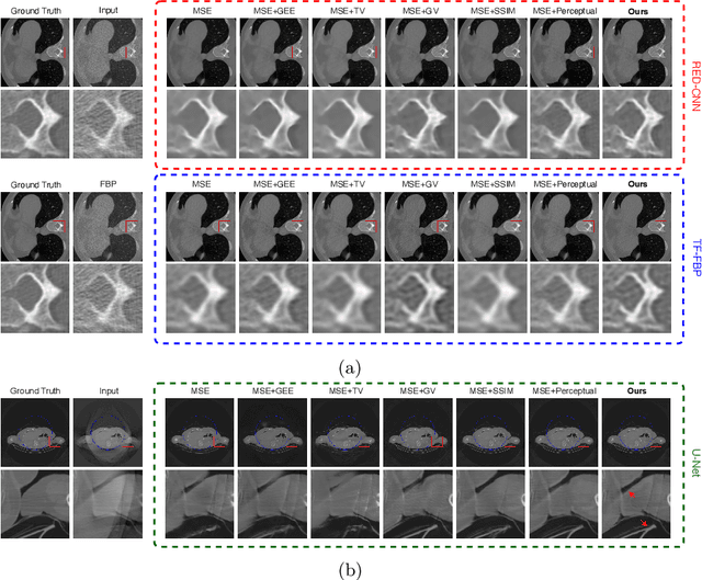 Figure 4 for EAGLE: An Edge-Aware Gradient Localization Enhanced Loss for CT Image Reconstruction