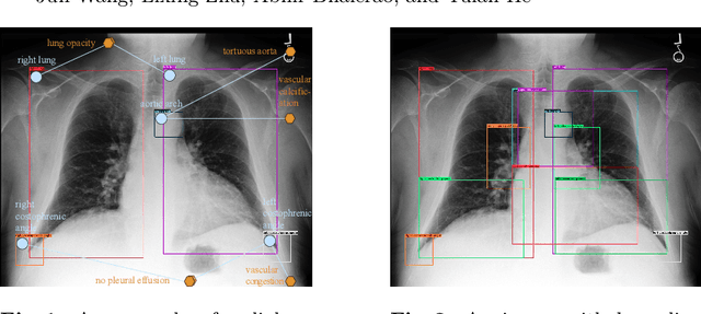 Figure 1 for Scene Graph Aided Radiology Report Generation