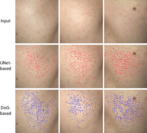 Figure 4 for Evaluating the Efficacy of Skincare Product: A Realistic Short-Term Facial Pore Simulation