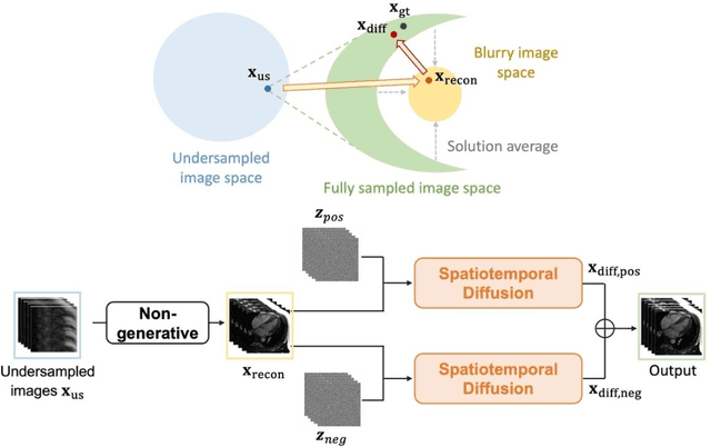 Figure 1 for Spatiotemporal Diffusion Model with Paired Sampling for Accelerated Cardiac Cine MRI