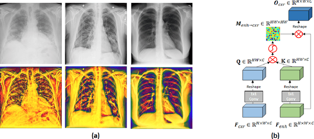 Figure 1 for Multi-Scale Feature Fusion using Parallel-Attention Block for COVID-19 Chest X-ray Diagnosis