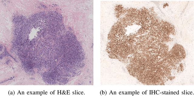 Figure 1 for Breast Cancer Immunohistochemical Image Generation: a Benchmark Dataset and Challenge Review