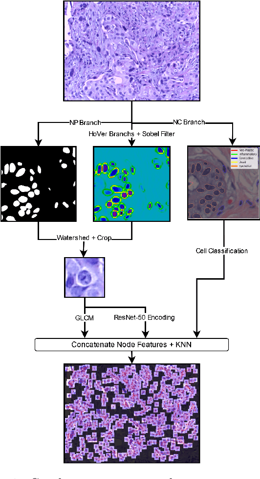 Figure 1 for Digital Histopathology with Graph Neural Networks: Concepts and Explanations for Clinicians