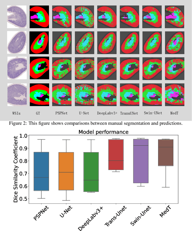 Figure 4 for Evaluation Kidney Layer Segmentation on Whole Slide Imaging using Convolutional Neural Networks and Transformers