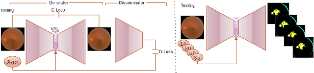 Figure 2 for Futuristic Variations and Analysis in Fundus Images Corresponding to Biological Traits