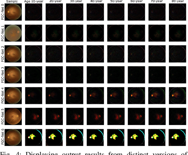 Figure 4 for Futuristic Variations and Analysis in Fundus Images Corresponding to Biological Traits