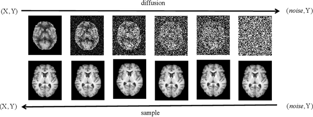 Figure 1 for Synthesizing PET images from High-field and Ultra-high-field MR images Using Joint Diffusion Attention Model