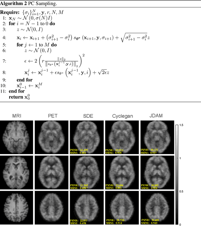 Figure 4 for Synthesizing PET images from High-field and Ultra-high-field MR images Using Joint Diffusion Attention Model