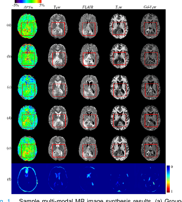 Figure 1 for Confidence-guided Lesion Mask-based Simultaneous Synthesis of Anatomic and Molecular MR Images in Patients with Post-treatment Malignant Gliomas