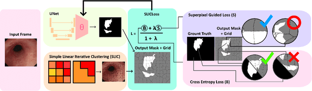 Figure 2 for SUPRA: Superpixel Guided Loss for Improved Multi-modal Segmentation in Endoscopy