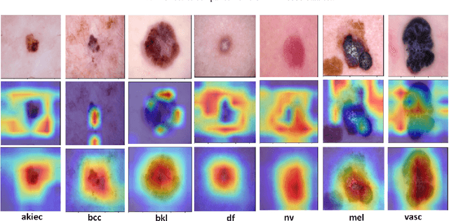Figure 3 for Progressive Class-Wise Attention (PCA) Approach for Diagnosing Skin Lesions