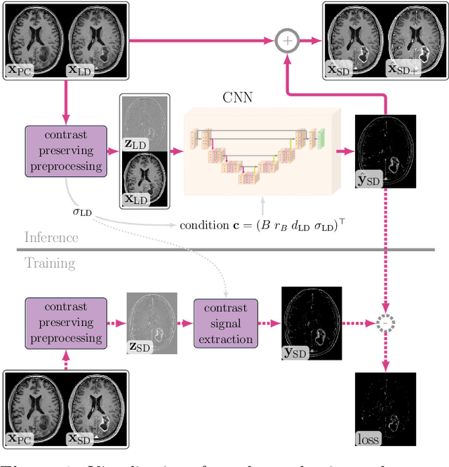 Figure 1 for Gadolinium dose reduction for brain MRI using conditional deep learning